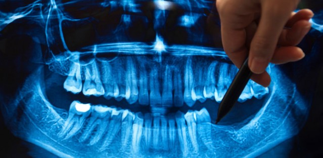 <!--:nl-->Radiologie en Medische Beeldvorming<!--:-->